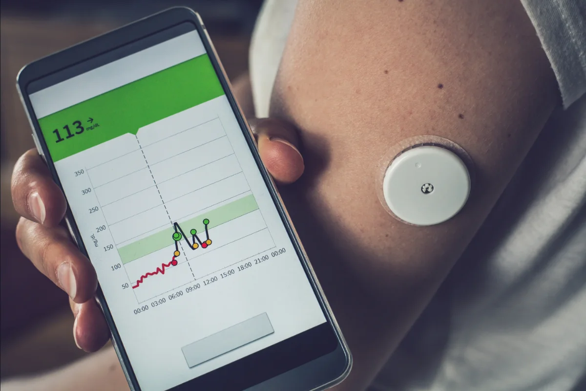 Adesivo para diabetes: 6 benefícios de usar!